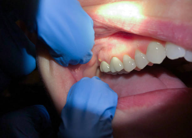 Best Cracked Tooth Emergency Dentist  in Hayesville, OR